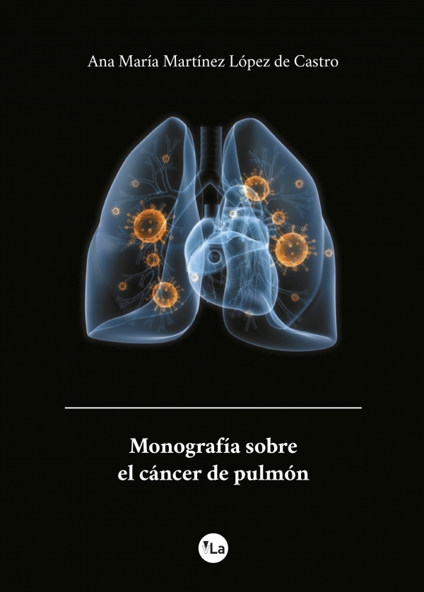 Monografía sobre el cáncer de pulmón